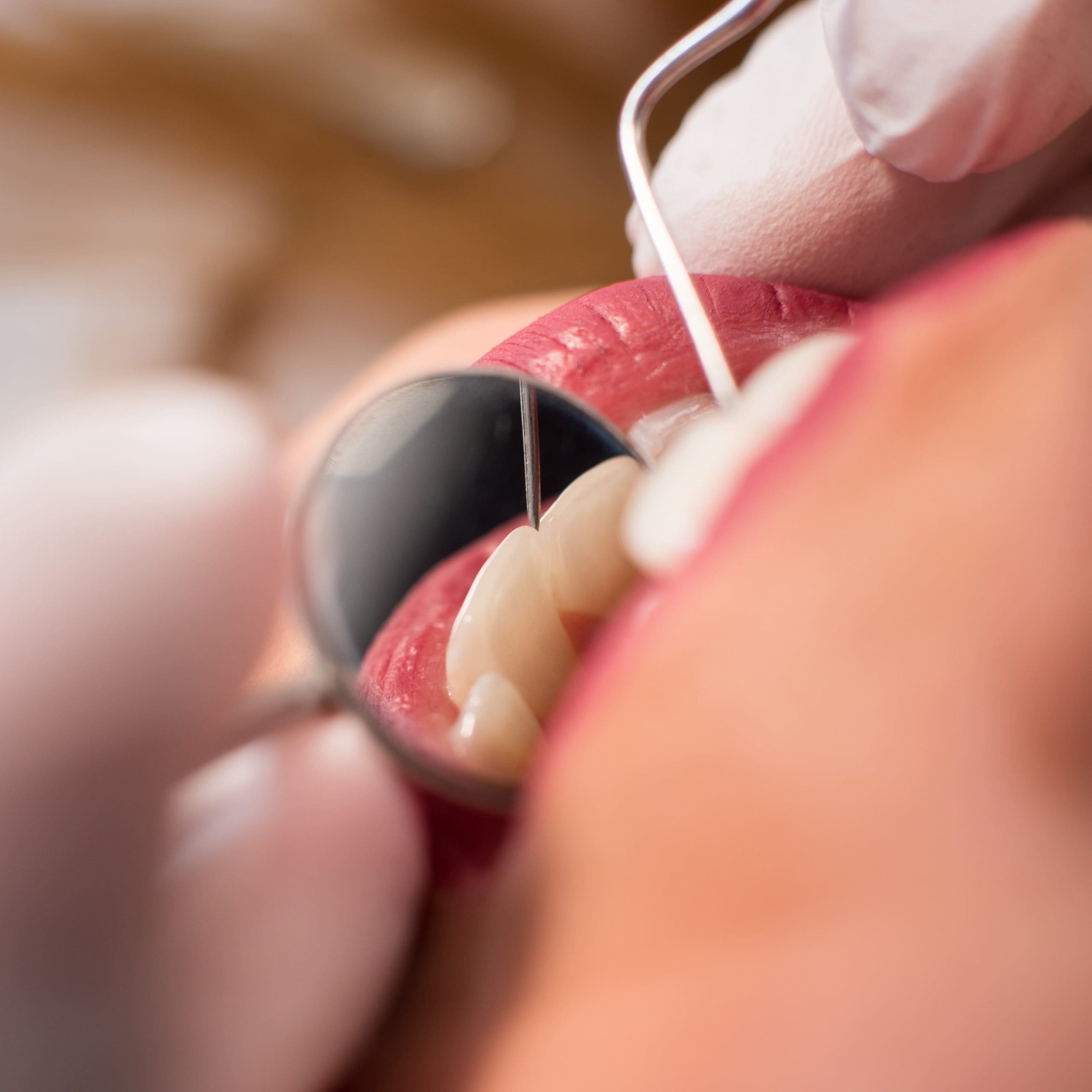 Dental Hygiene - Parkway Clinic - Top Image 1A